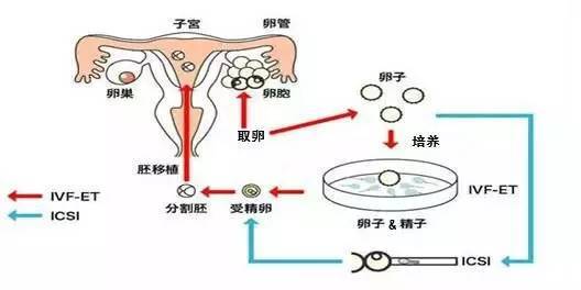 沈阳试管